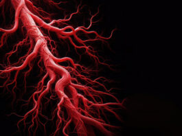 Symbolbild Arterie (red Arteriography, Radiographic examination of blood vessels using a contrast dye injected into the arteries background.) Copyright: Ольга Лукьяненко - stock.adobe.com