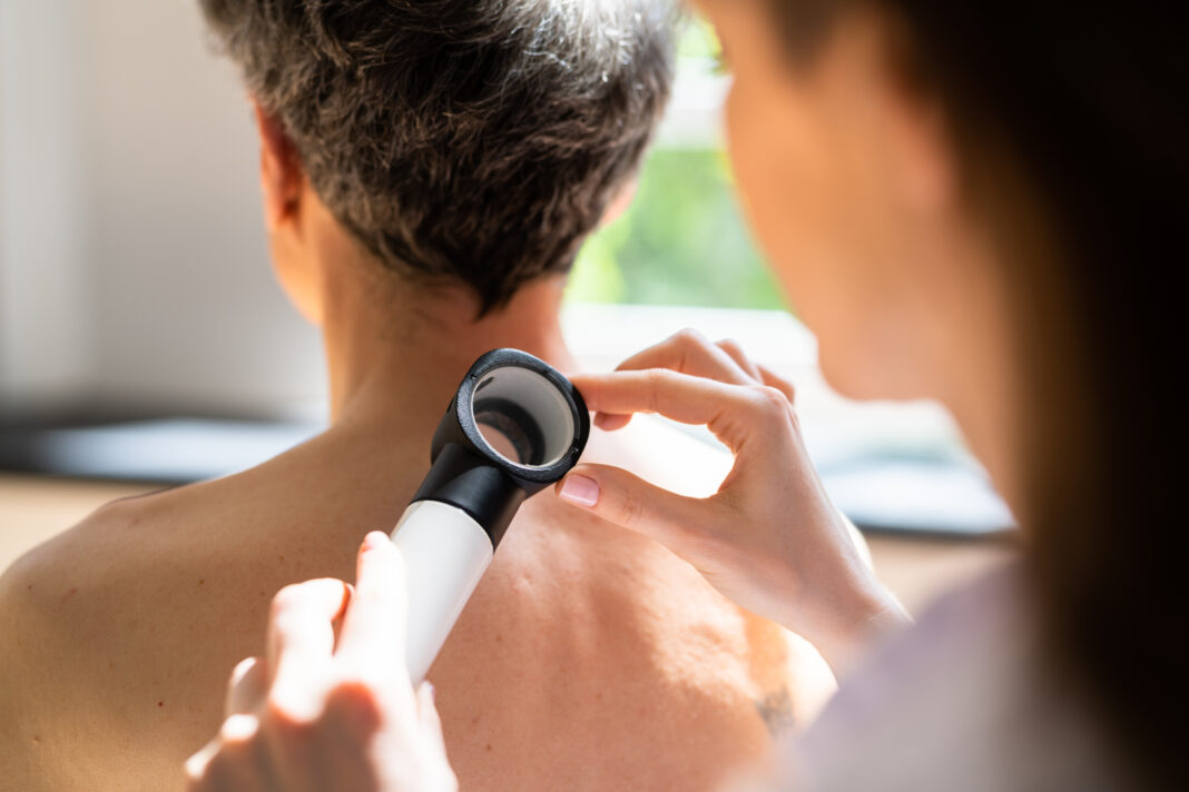 Dermatologist Checking Skin Allergy. Copyright: Andrey Popov - stock.adobe.com