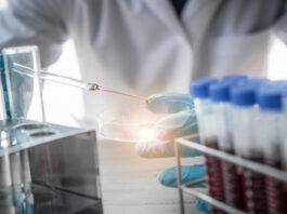 lab technician assistant analyzing a blood sample in test tube at laboratory. Medical, pharmaceutical and scientific research and development concept. Copyright: totojang1977 - stock.adobe.com